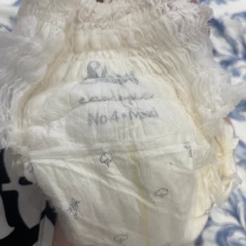 Acil İlgilenilmeli Sleepy Külot Bez Yabancı Maddeler