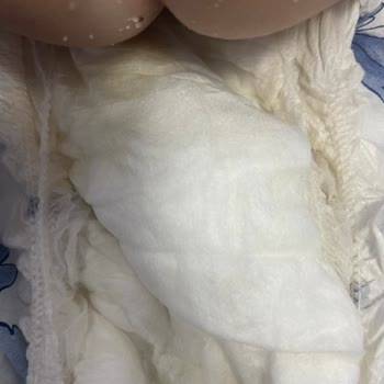 Acil İlgilenilmeli Sleepy Külot Bez Yabancı Maddeler