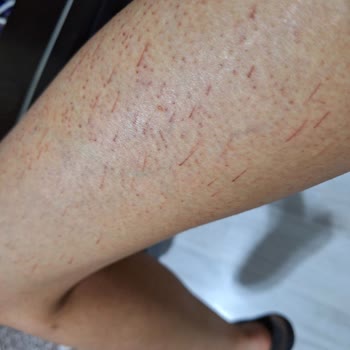 Yaşam Güzellik Merkezi (Kurtalan) İnsanların Sağlığı İle Oynuyor