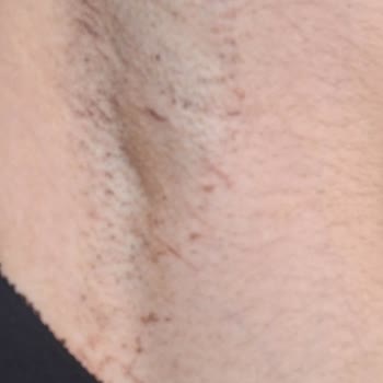 Yaşam Güzellik Merkezi (Kurtalan) İnsanların Sağlığı İle Oynuyor