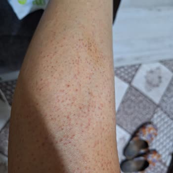 Yaşam Güzellik Merkezi (Kurtalan) İnsanların Sağlığı İle Oynuyor