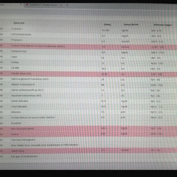 Ajet Havayolu Şirketinin İlgisizliği