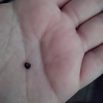 Özeller Group Çıtıros Cips İçinden Taş Çıktı