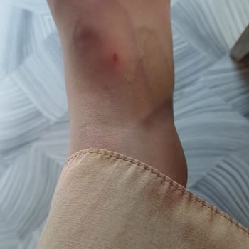 Derimod Hatalı Ürün Verdi