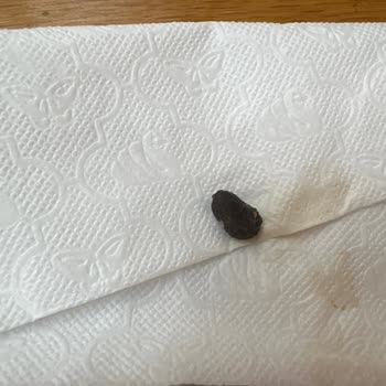 Simit Sarayı Poğaçadan Zeytin Çekirdeği Çıktı!