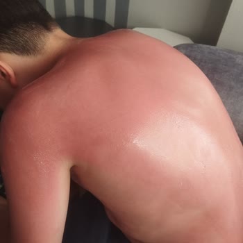 BİM Güneş Kremi Mağduriyeti