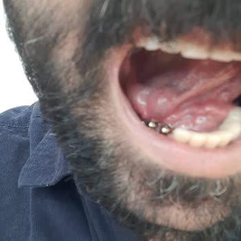 DentaCenter Diş Tedavisi Mağduriyetim