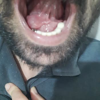 DentaCenter Diş Tedavisi Mağduriyetim