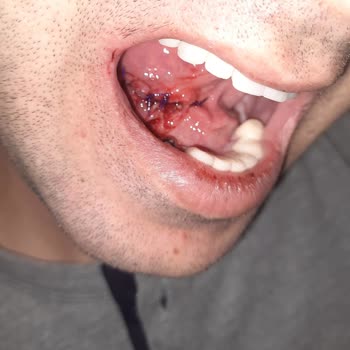 DentaCenter Diş Tedavisi Mağduriyetim