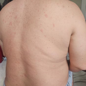Ozekpharma.com Dan Kiperin Collagen Satin Aldım