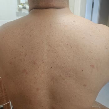 Ozekpharma.com Dan Kiperin Collagen Satin Aldım