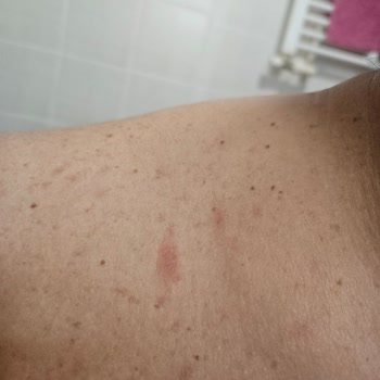 Ozekpharma.com Dan Kiperin Collagen Satin Aldım