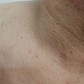 Ozekpharma.com Dan Kiperin Collagen Satin Aldım