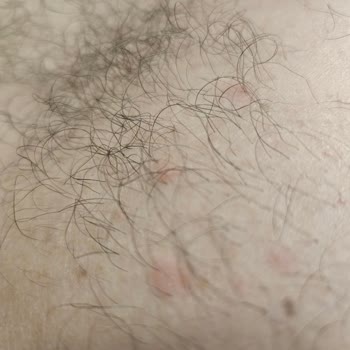 Ozekpharma.com Dan Kiperin Collagen Satin Aldım