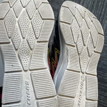 Skechers Çocuk Ayakkabısı Şikayeti