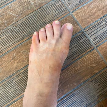 Birkenstock Ayağa Boya Akıtması