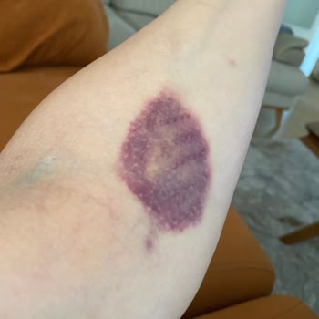 Medicana İzmir Tecrübesiz Personel