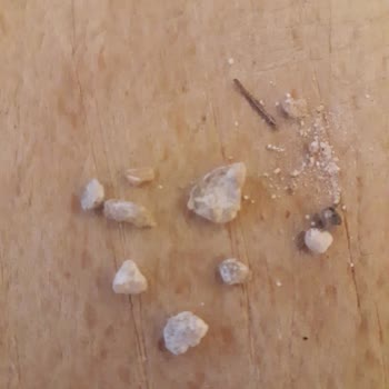 Nora Un İçinde Sert Ve Yabancı Cisimler