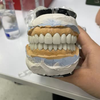 Başakşehir Tıp Merkezi Başak Tıp Merkezi Diş Tedavi Süreci Değerlendirmesi