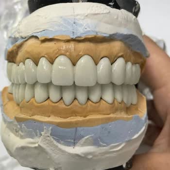 Başakşehir Tıp Merkezi Başak Tıp Merkezi Diş Tedavi Süreci Değerlendirmesi