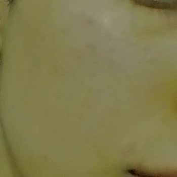 Bioderma Yüzümde Sivilceye Neden Oldu