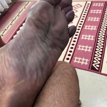 Scooter Ayakkabı Renk Akmasına. Şikayeti