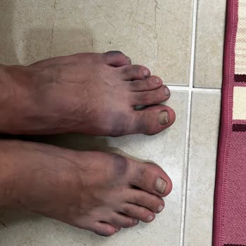 Scooter Ayakkabı Renk Akmasına. Şikayeti