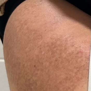 Dr. Servet Usta Muayenehane Tedavi Süreci Ve Sonuçları