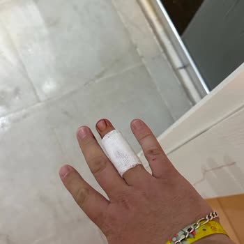 Batıhan Beach Resort Kuşadası Otelinde Yaşanan Sorunlar Ve Müşteri Hizmetleriyle İlgili Şikayetler