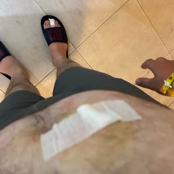 Batıhan Beach Resort Kuşadası Otelinde Yaşanan Sorunlar Ve Müşteri Hizmetleriyle İlgili Şikayetler