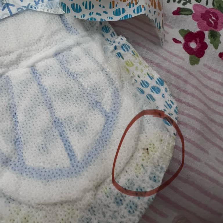 Kotex Marka, Açılmamış Tekli Ped İçerisinden Böcek Çıktı.