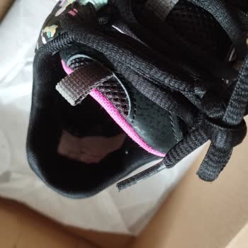 Skechers Beymen Sorunlu Ürün Müşteri Memnuniyetsizliği