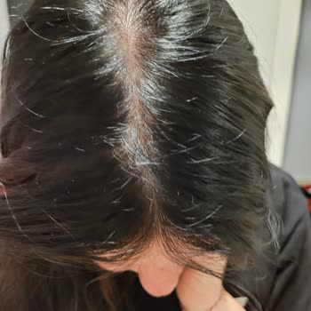 Palette Saç Boyası Yanlış Renk Çıktı