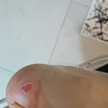 Elle Ayakkabı Ayakları Mahvediyor Ürünü Pahalı Kalitesiz Ürün Üretiyor
