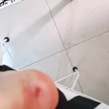 Elle Ayakkabı Ayakları Mahvediyor Ürünü Pahalı Kalitesiz Ürün Üretiyor