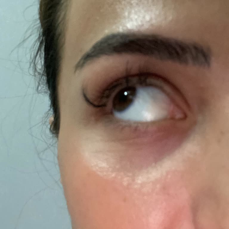 Sevil Kılıç (Instagram: sevilashes0) İpek Kirpik Faciası Ve Mağduriyeti