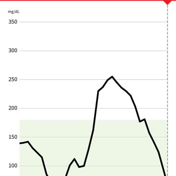Freestyle Libre Libre Sensör 2 Gün İçinde Çok Fazla Benim Farkı
