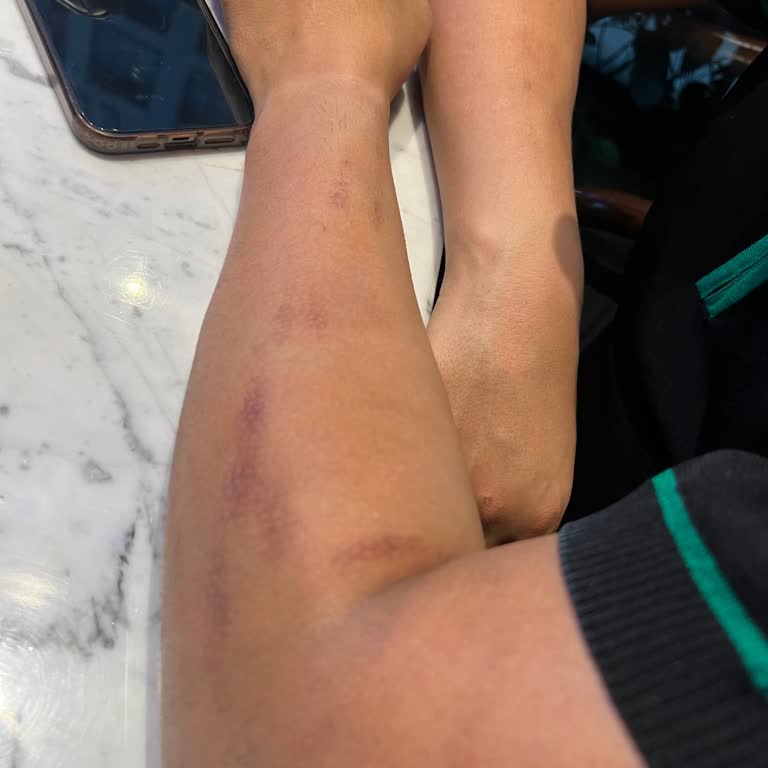 Fernes Estetik Florya Ticarethane Yapmışlar G