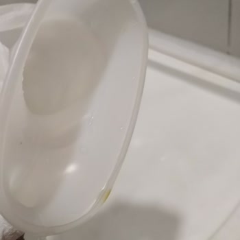 Kolan Hospital Büyükçekmece Hijyensiz Ve Pis, Bakımsız