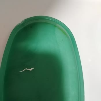 Kolan Hospital Büyükçekmece Hijyensiz Ve Pis, Bakımsız