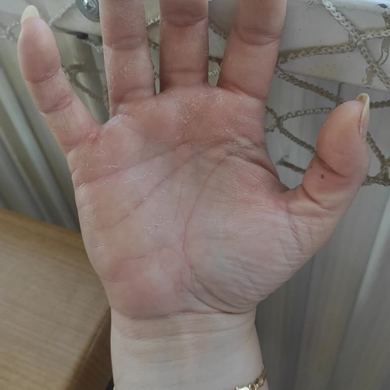 İzmir Büyükşehir Belediyesi Menemen Egekent 2 Kireçli Su