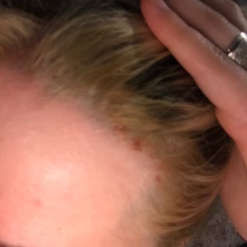 Palette Saç Boyası Saç Derimi Yaktı