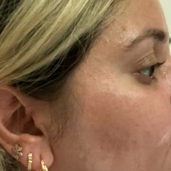 Loreal Pişmanlıktır. Benim İçin Bitmiştir.