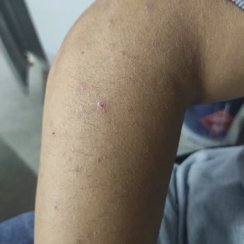 Enza Güzellik Merkezleri Enza Beauty Hüsrandır