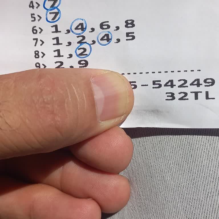 Tjk Ödeme Yapmıyor