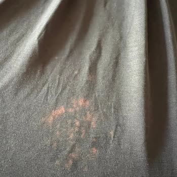 Dr.Beckmann Ürün Kalitesi Ve Tazminat Talebi