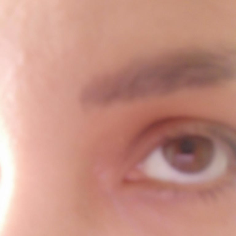 Elvan Abalı Güzellik Merkezi İpek Kirpik Dökülmesi