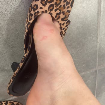 Bershka Terlik İadesini Almıyor