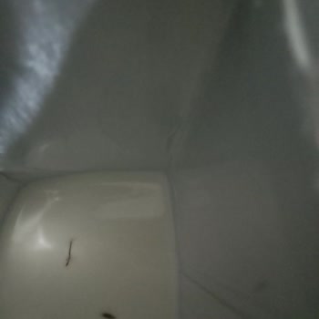 Pınar Su ve İçecek Çocuk Devam Sütünde Yabancı Cisim Şikayeti