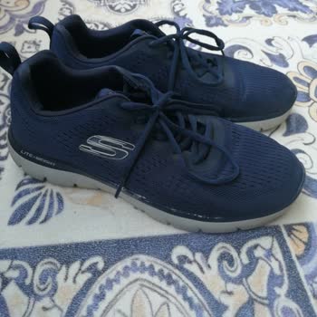 Skechers Umursamazlığı Bir Daha Asla Almam